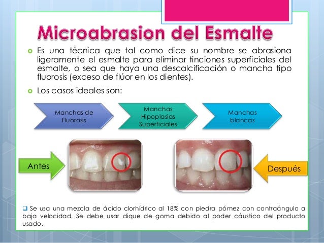 Las manchas de pigmento a las muchachas en el cuerpo