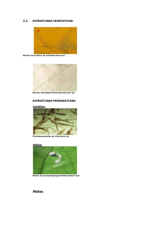 ESTRUCTURA HONGOS estructura hongos: