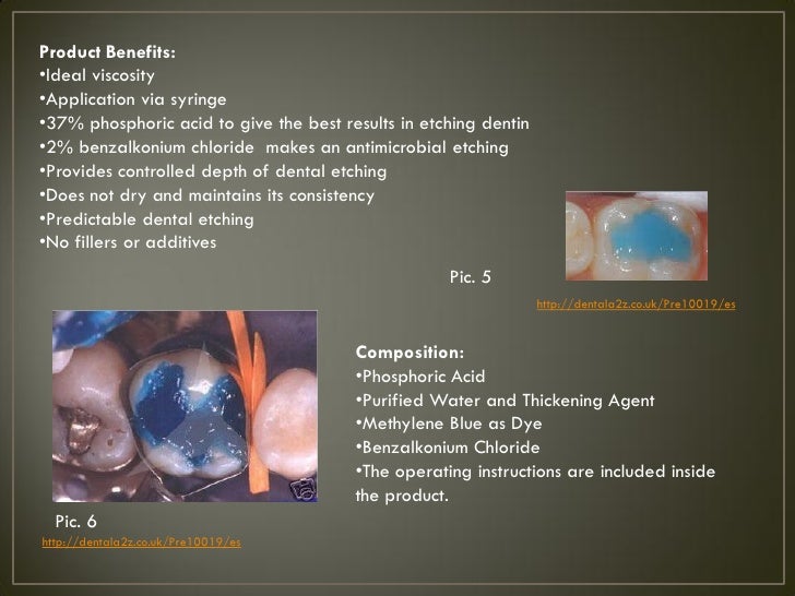 Etchant in dentistry