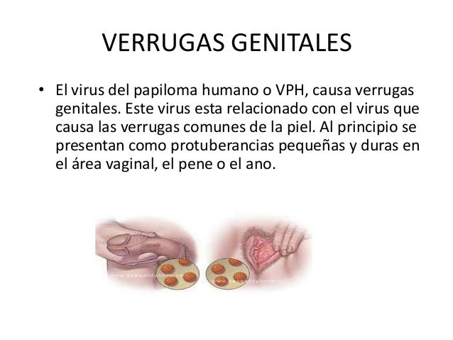 Si aumentar realmente el pene sin operación