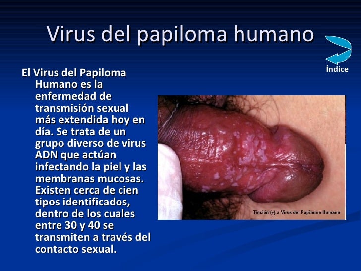 Como se ven los huevos de las lombrices en kale de la persona