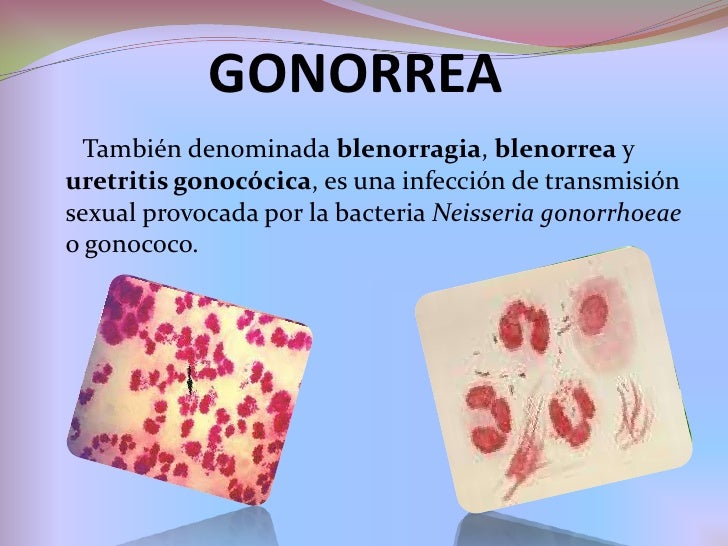 Como aumentar el miembro sin pastilla