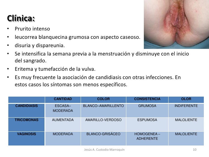 tratamiento-farmacolgico-de-las-ets-10-7