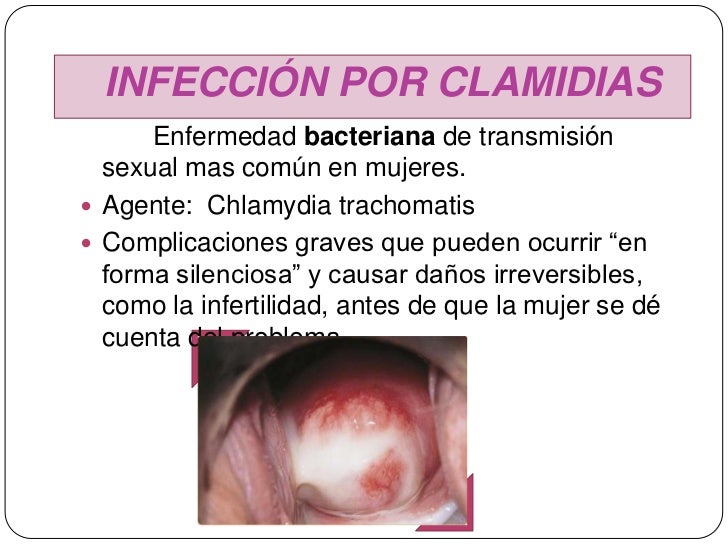 Si duele la espalda y bajo los pechos de derecho duele