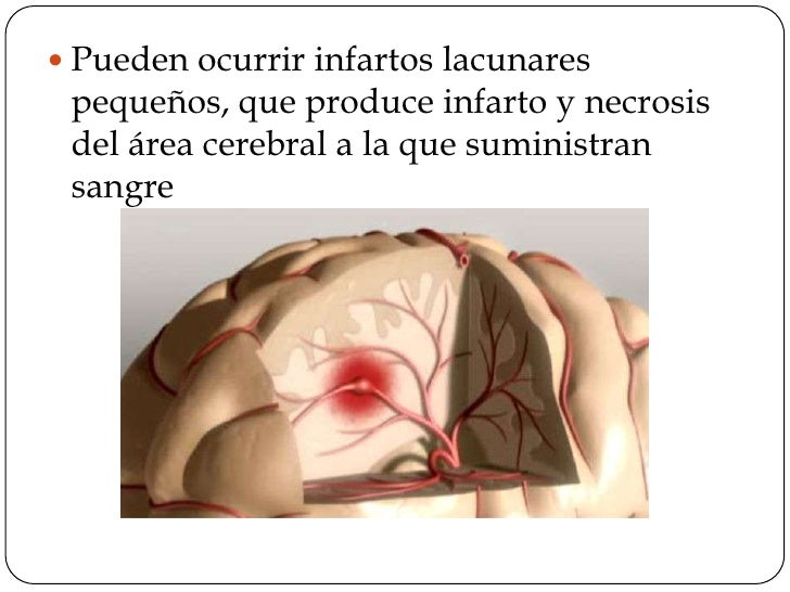 Los dolores en lo bajo del vientre a los lados y en los riñones a las mujeres de la causa