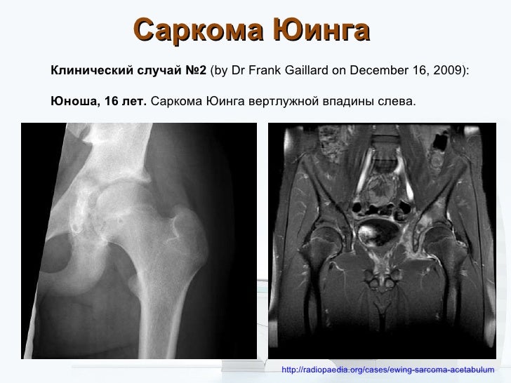 На пальце ноги пузырьки с жидкостью чем лечить