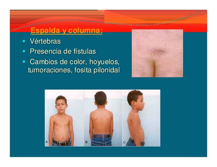 Por que fruta u hortaliza aumentar el miembro