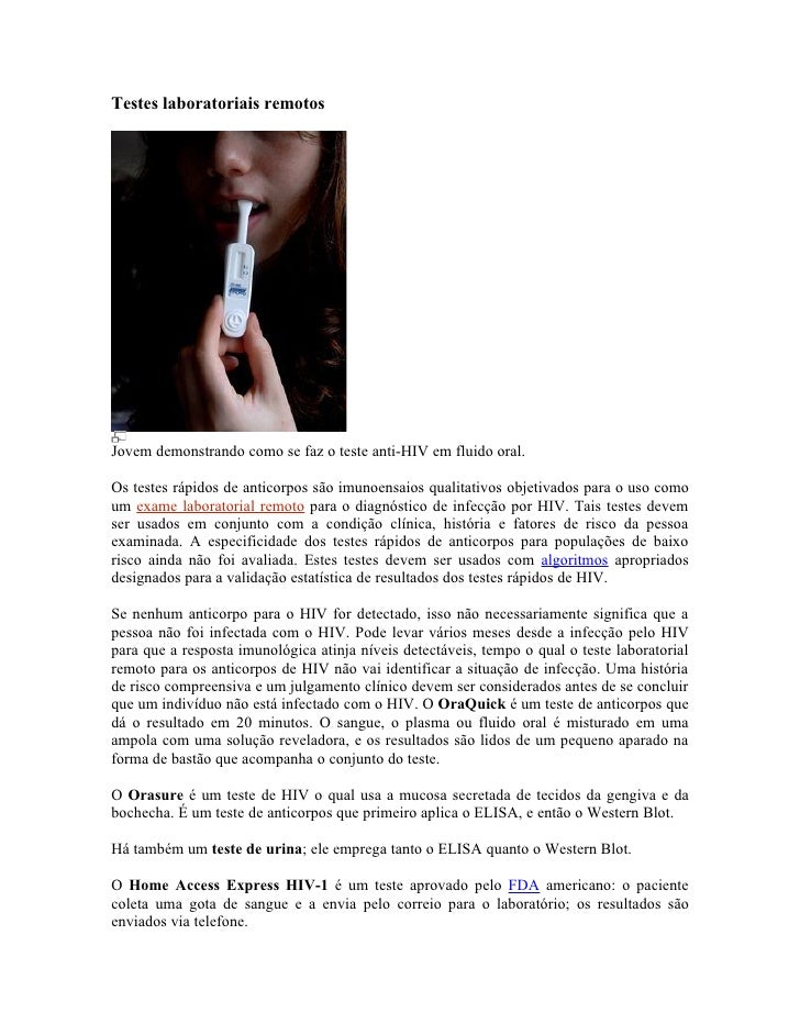 Exame elisa hiv