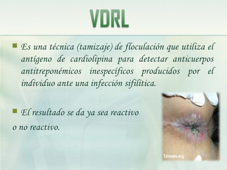 exámenes de laboratorio clínico