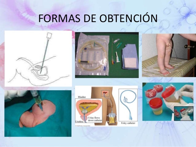 Examenes de laboratorio (BH, QS, TP, TPT, EGO) Examenes de laboratorio (BH, QS, TP, TPT, EGO)