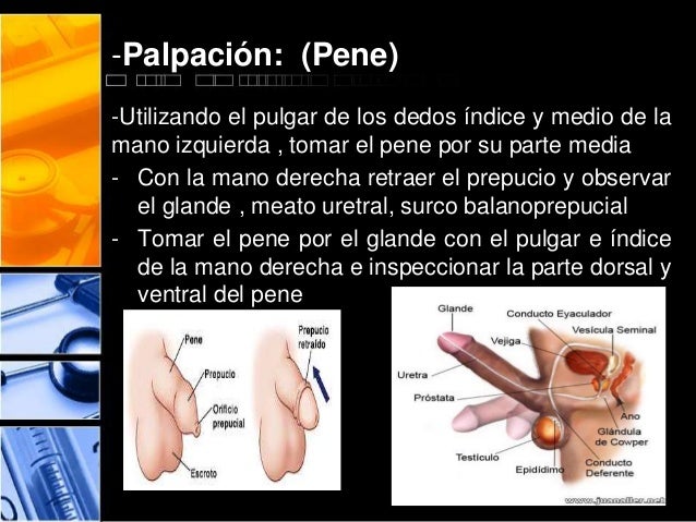 Si un más pequeño miembro