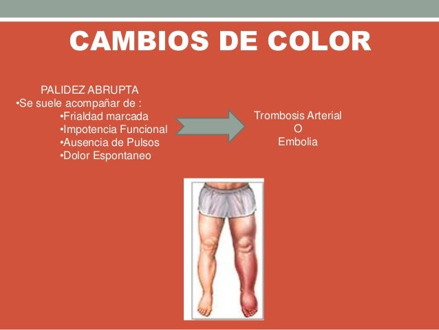 CAMBIOS DE COLOR
PALIDEZ ABRUPTA
•Se suele acompañar de :
•Frialdad marcada
•Impotencia Funcional
•Ausencia de Pulsos
•Dol...