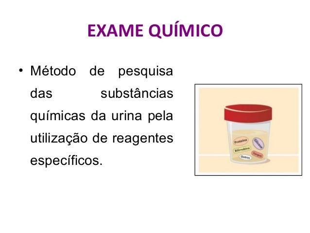Urina i exame