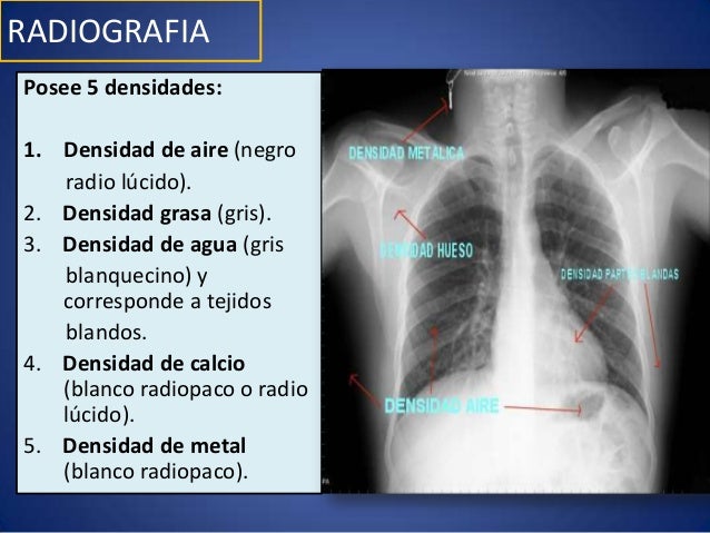 Exames complementarios