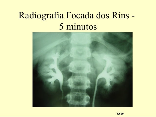 Exame de rins