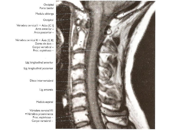 Exame da coluna cervical