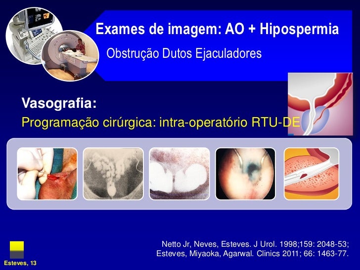 Exame de na
