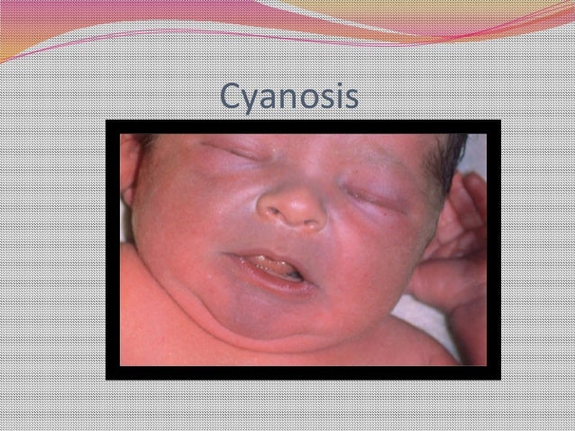 examination of the newborn examination of the newborn