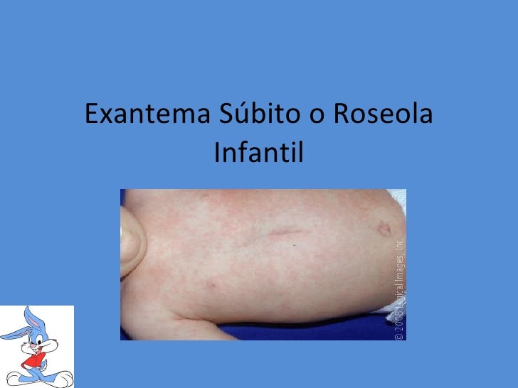 Roseola (Sixth Disease) Condition, Treatments, and ...