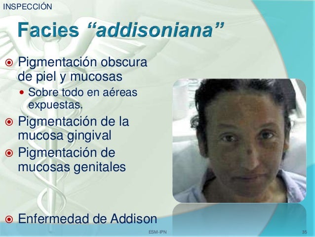 Eficaz la máscara de la pigmentación para la persona