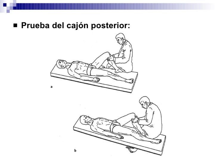 Exploración de rodilla
