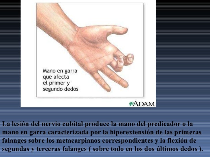 Exploracion neurologica comp.