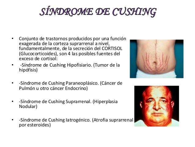 Sobre la utilidad del masaje a la osteocondrosis