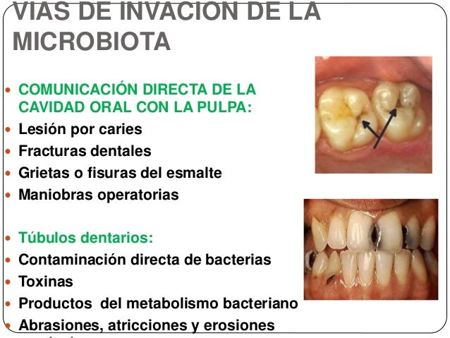El tratamiento de la psoriasis por el cáñamo
