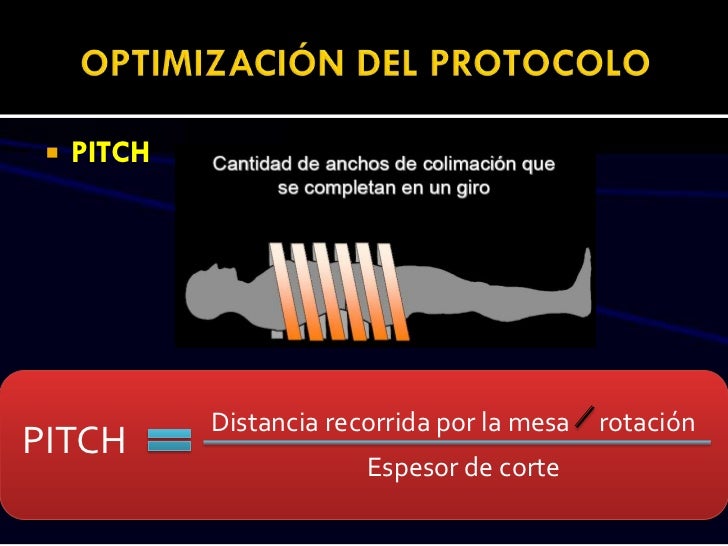 Que Es El Pitch En Tomografia Image to u