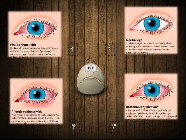 eye disorders Age-related eye diseases and conditions and other programs with respect to blinding eye diseases, visual disorders, mechanisms of visual function,. eye disorders Age-related eye diseases and conditions and other programs with respect to blinding eye diseases, visual disorders, mechanisms of visual function,.