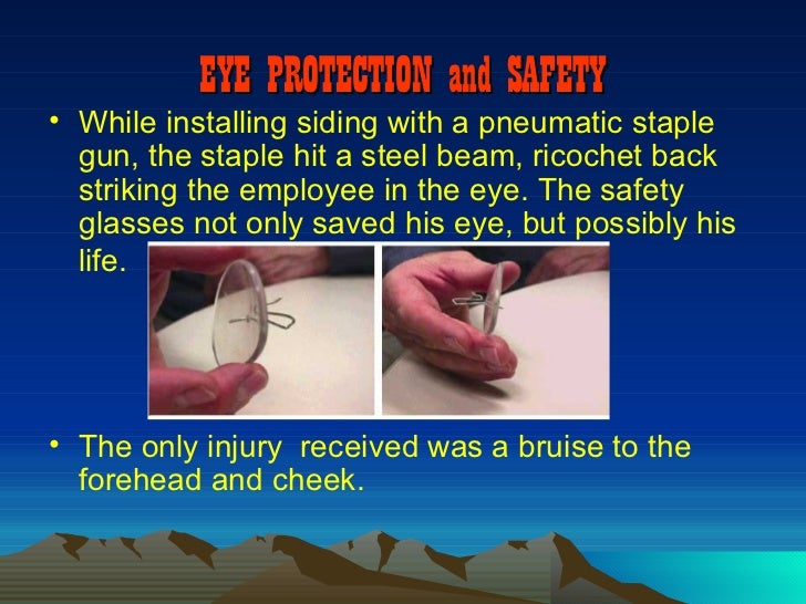Accidents From Not Wearing Safety Glasses Accidents From Not Wearing Safety Glasses