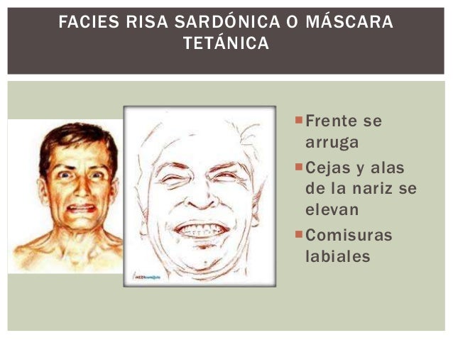 Facies