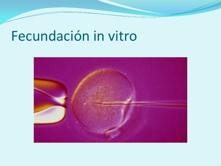 to in vitro or end vitro essay Shortly after my insights on the clinical problems with in vitro fertilization were out a media blast calling for an end to the business of. to in vitro or end vitro essay Shortly after my insights on the clinical problems with in vitro fertilization were out a media blast calling for an end to the business of.