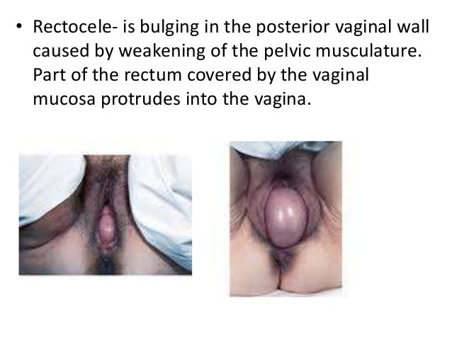 Ufa increase penis