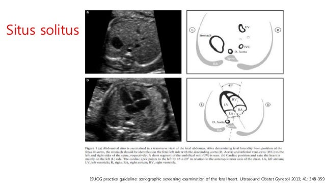 Fetal echocardiography diagram of cat trachea 