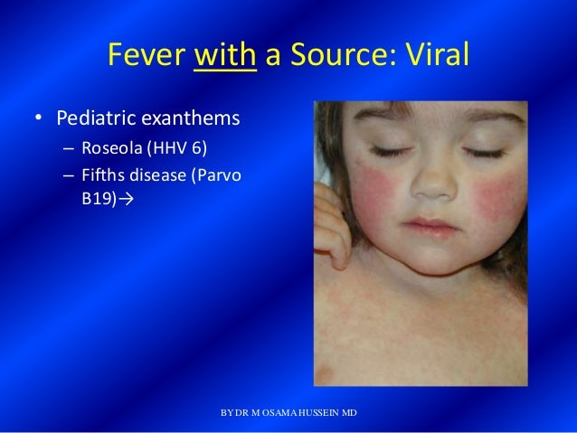 the fifth disease the fifth disease