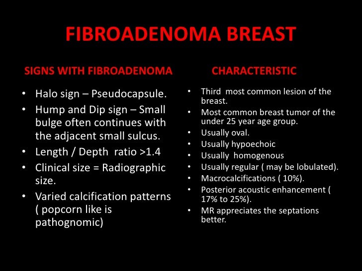 Fibroadenoma Breast