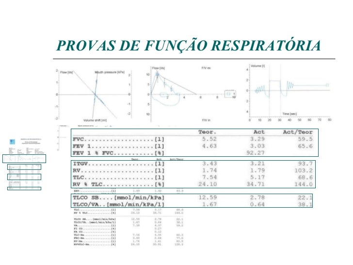 Exame funcao pulmonar