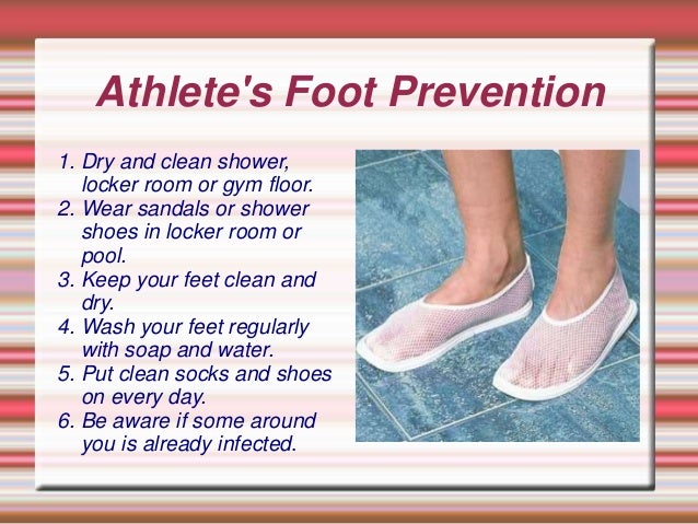 how do you get athletes foot out of shoes how do you get athletes foot out of shoes 28 images how do you get athletes foot out of shoes how do you get athletes foot out of shoes 28 images