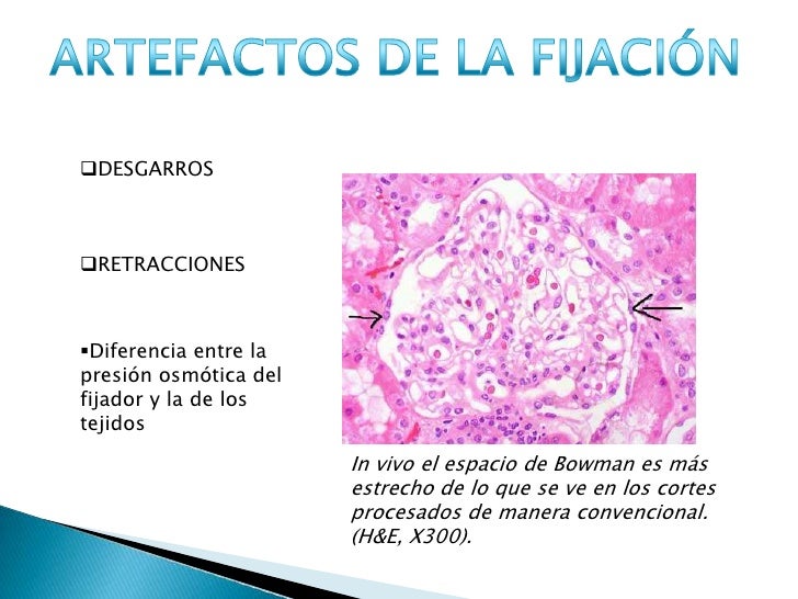 Fijación