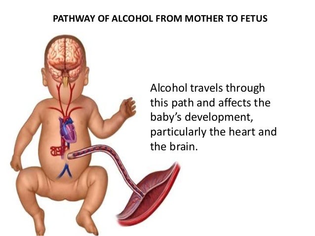 Fetal alcohol syndrome essay free