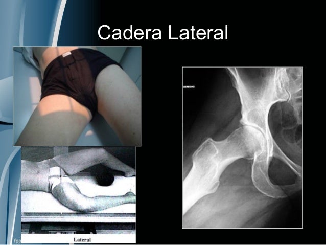 PROYECCIÓNES RADIOLÓGICAS EN TRAUMATOLOGÍA