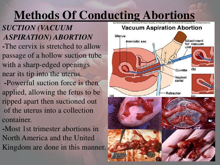 Natural Ways Of Abortion 108