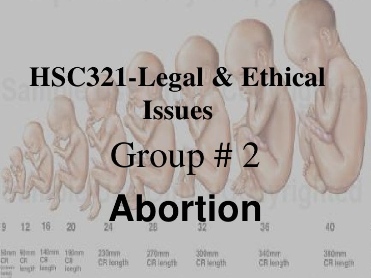 abortion-ppt