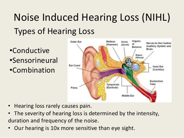 Image result for Noise Induced Hearing Loss and Tinnitus