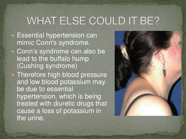 Final production conn's