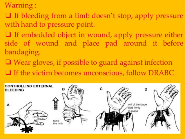 first aid for bruising #10