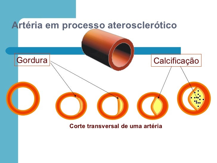 Fisiologia E Anatomia Do Sistema Cardiovascular Fisiologia E Anatomia Do Sistema Cardiovascular