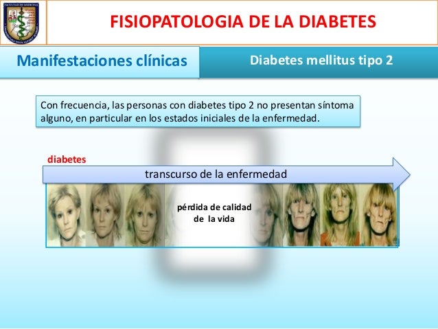 Fisiopatologia de la diabetes mellitus tipo 2 Fisiopatologia de la diabetes mellitus tipo 2