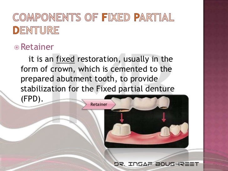 Fixed prosthodontics lesson 5